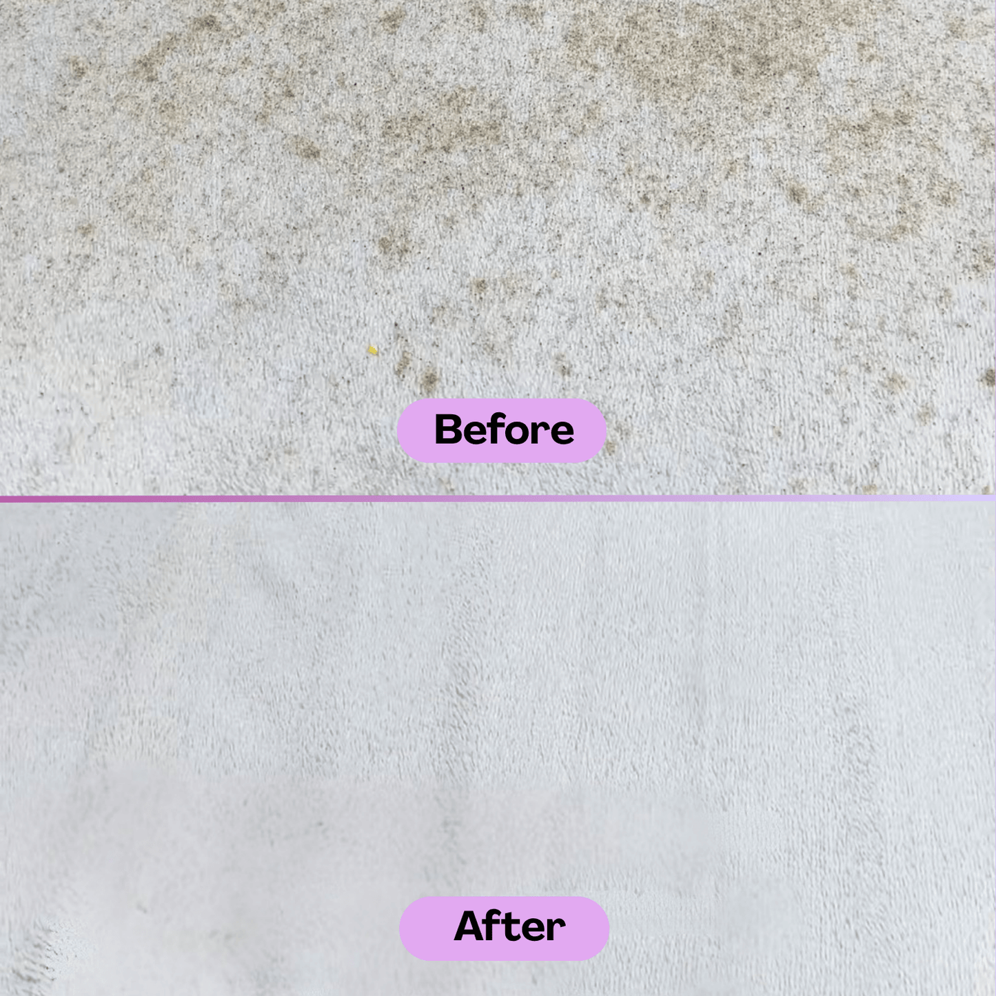 Melenis™ Ultrasonic Vacuum