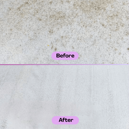 Melenis™ Ultrasonic Vacuum